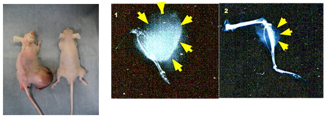 図１　TRAMPマウスの前立腺癌組織をヌードマウス脛骨に移植。左：WNT5A＋（コントロール）右：WNT５A―（ノックアウト）WNT５Aのノックアウトで癌増殖が抑制される